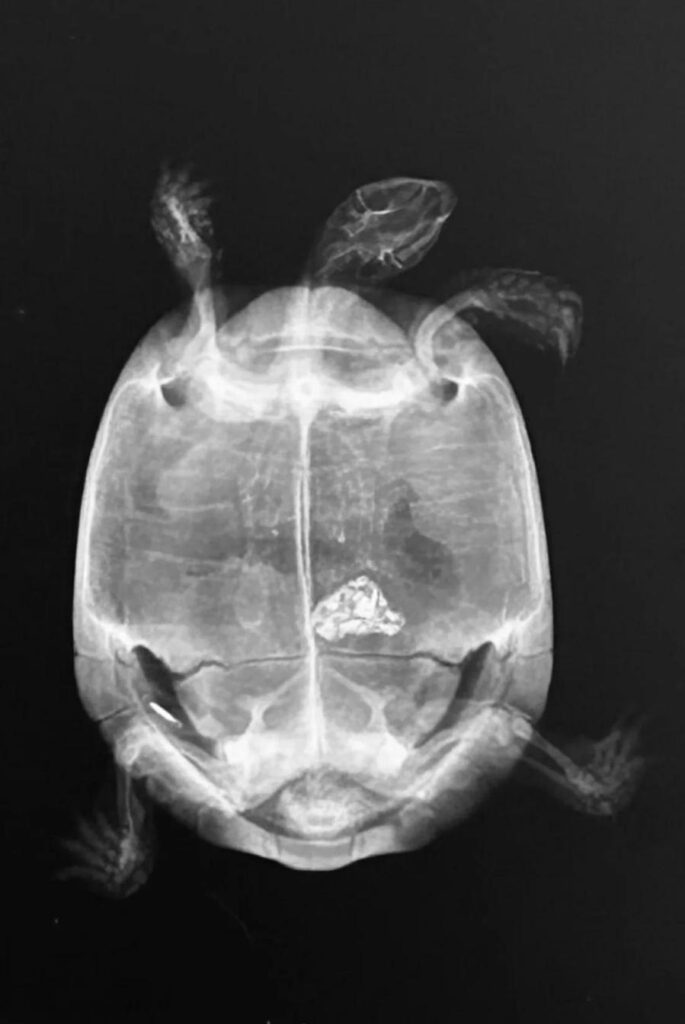 radiografia